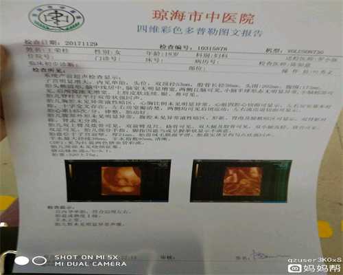 广州非孕价格-广州找代孕的论坛-广州代孕最靠谱